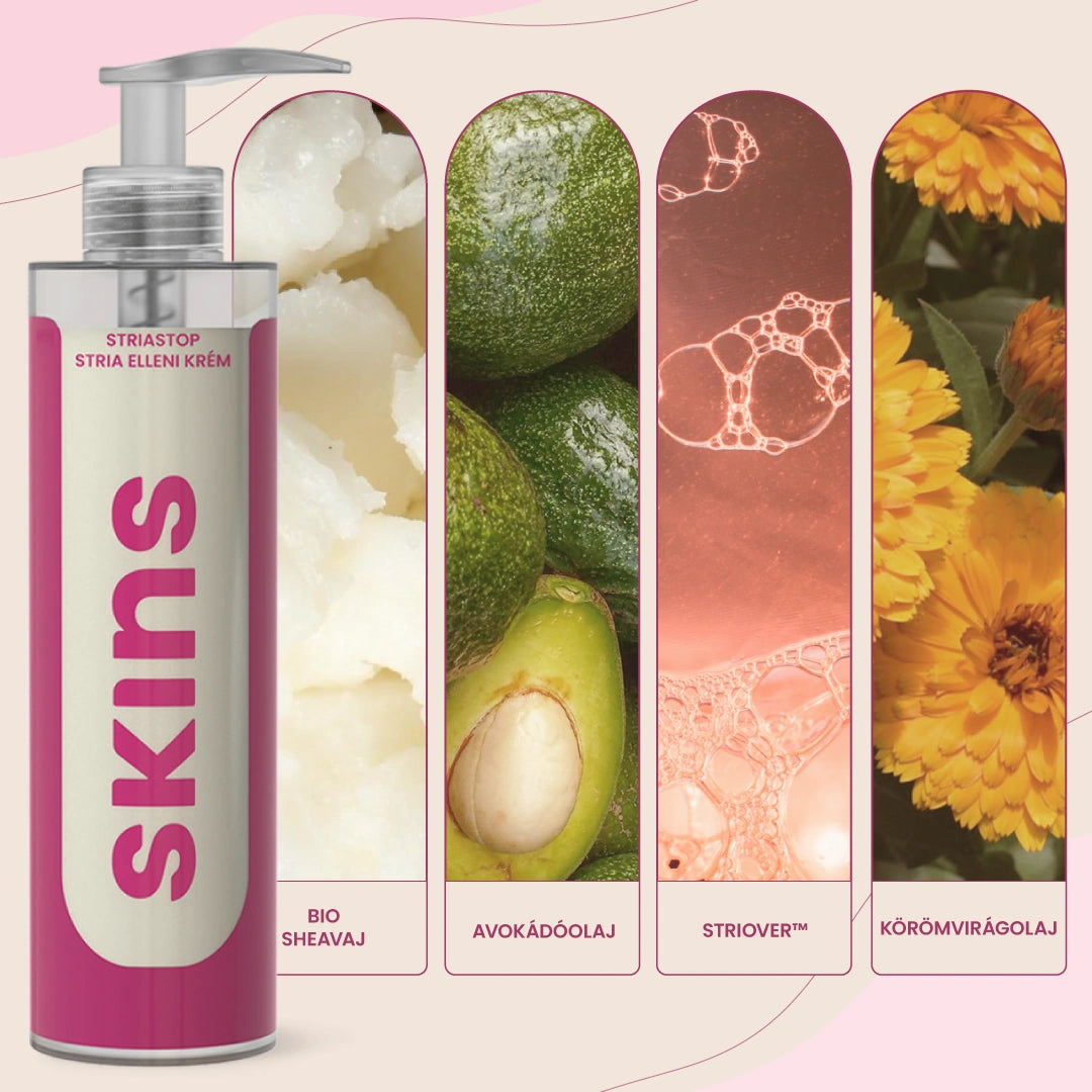 SKINS StriaStop Stria Elleni Krém Striover™ Hatóanyaggal 200ml